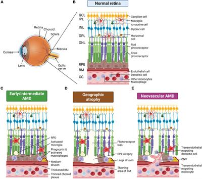 Frontiers Exploring The Pathogenesis Of Age Related Macular